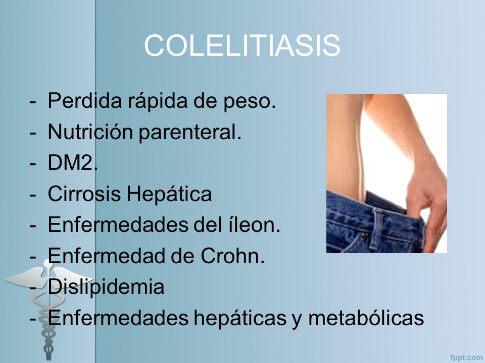 Colelitiasis por perdida de peso Colelitiasis por perdida de peso